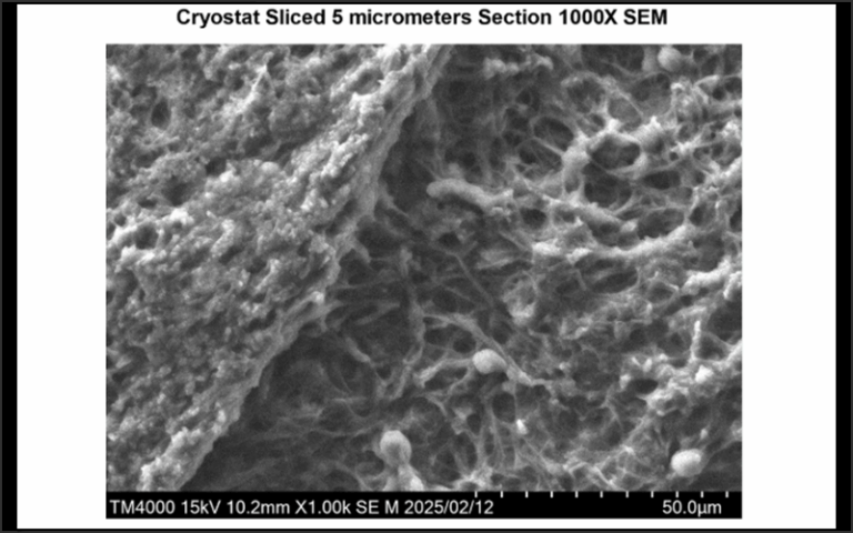 GROUND ZERO EXCLUSIVE: Dr. Kevin W. McCairn's Latest Findings on Anomalous Fibrin Structures