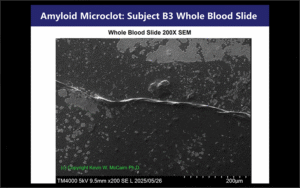 How Biowarfare Attacked The Children